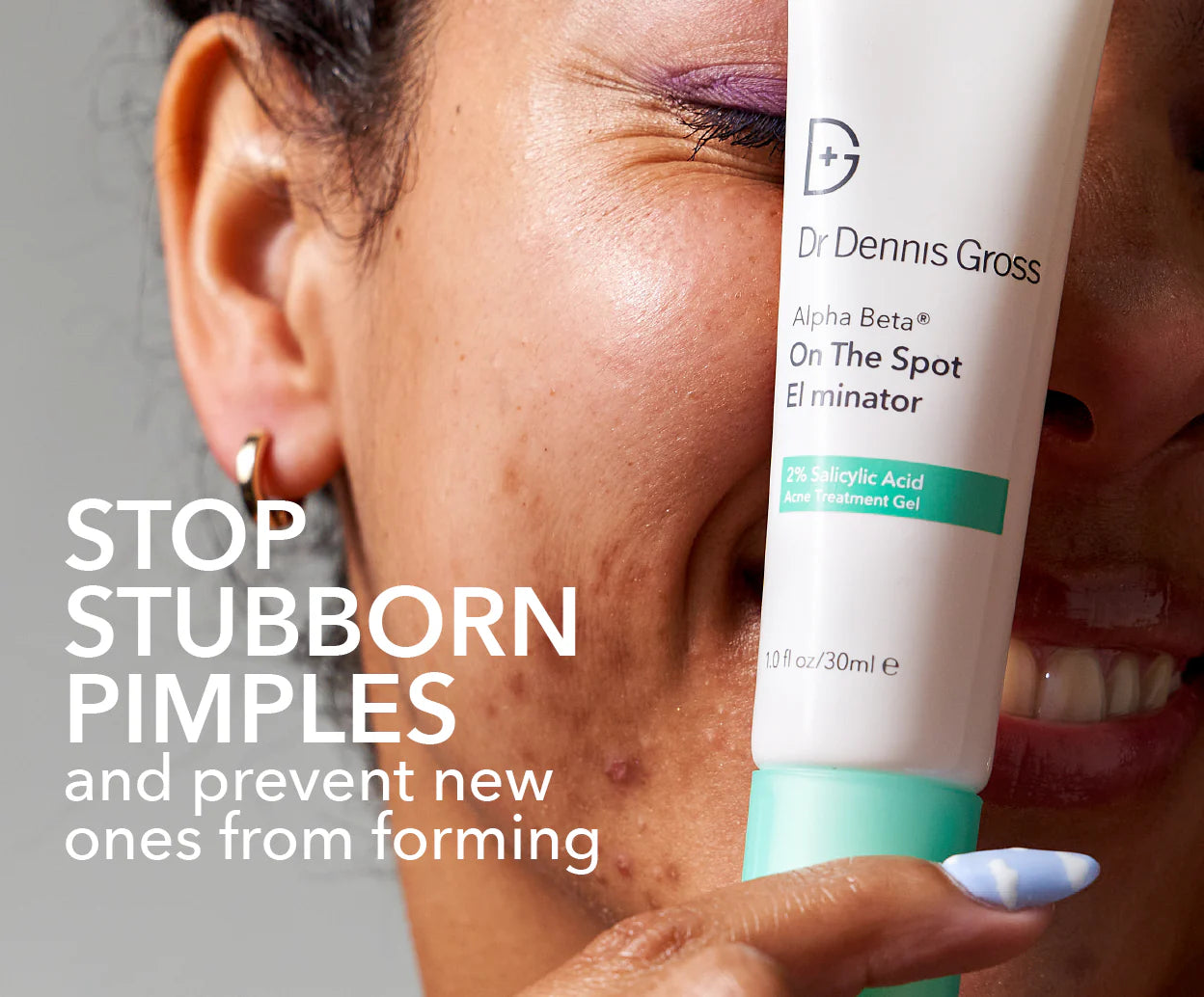 Alpha Beta® On The Spot Eliminator Gel